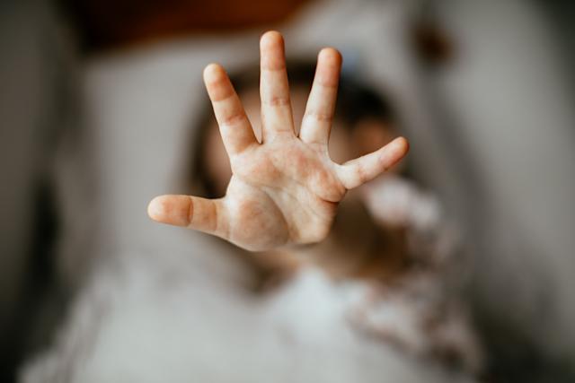 Imagem meramente ilustrativa