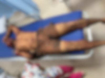 Suspeito de atear fogo em viatura morre em confronto com a polícia