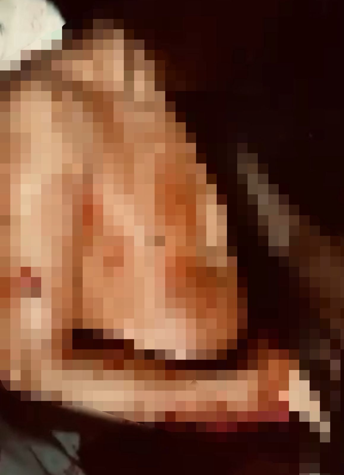 Homem leva mais de 15 tiros em tentativa de homicídio na cidade balneária