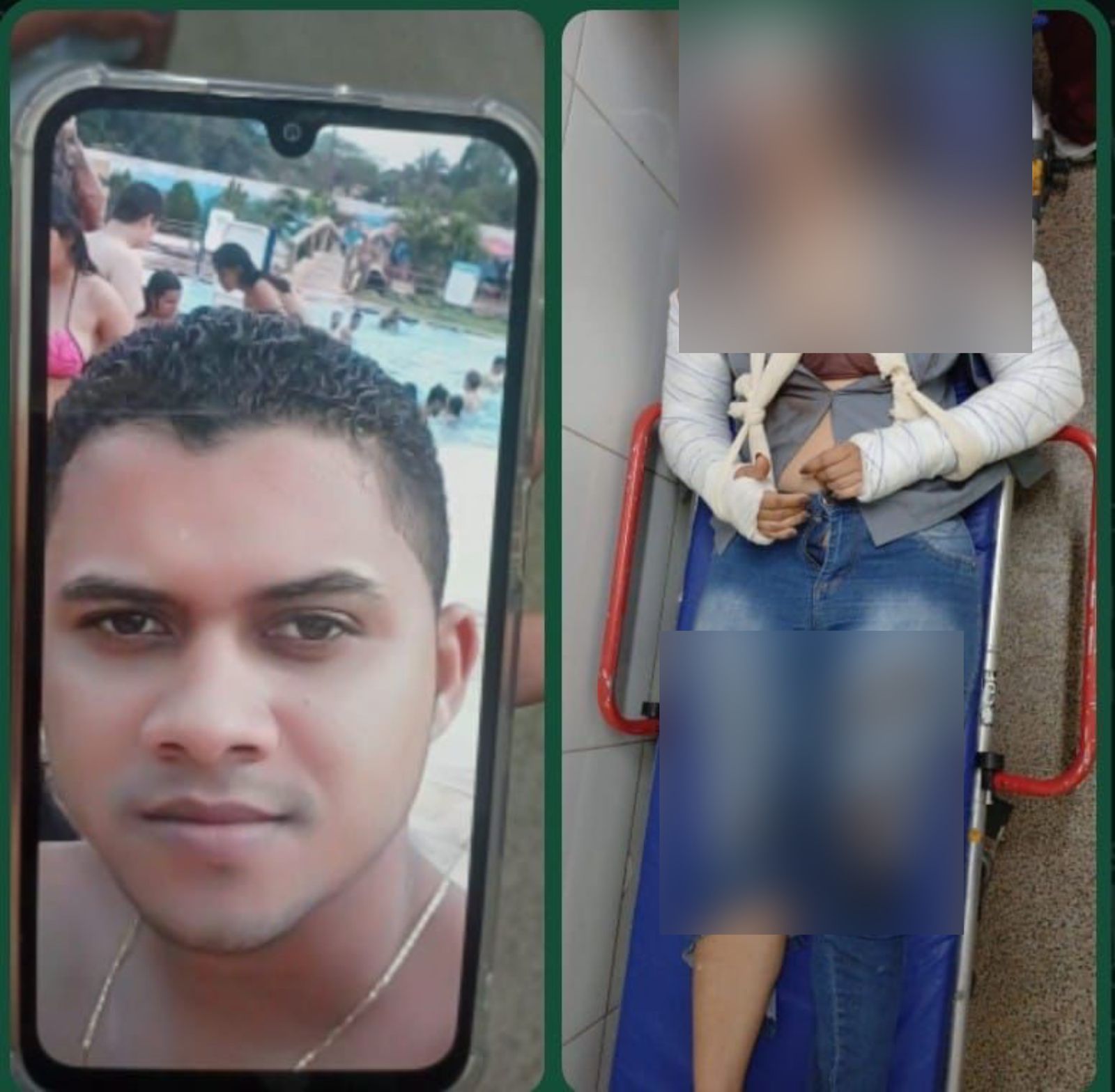 Tentativa de Feminicídio: mulher é espancada e tem os dois braços quebrados pelo ex-companheiro