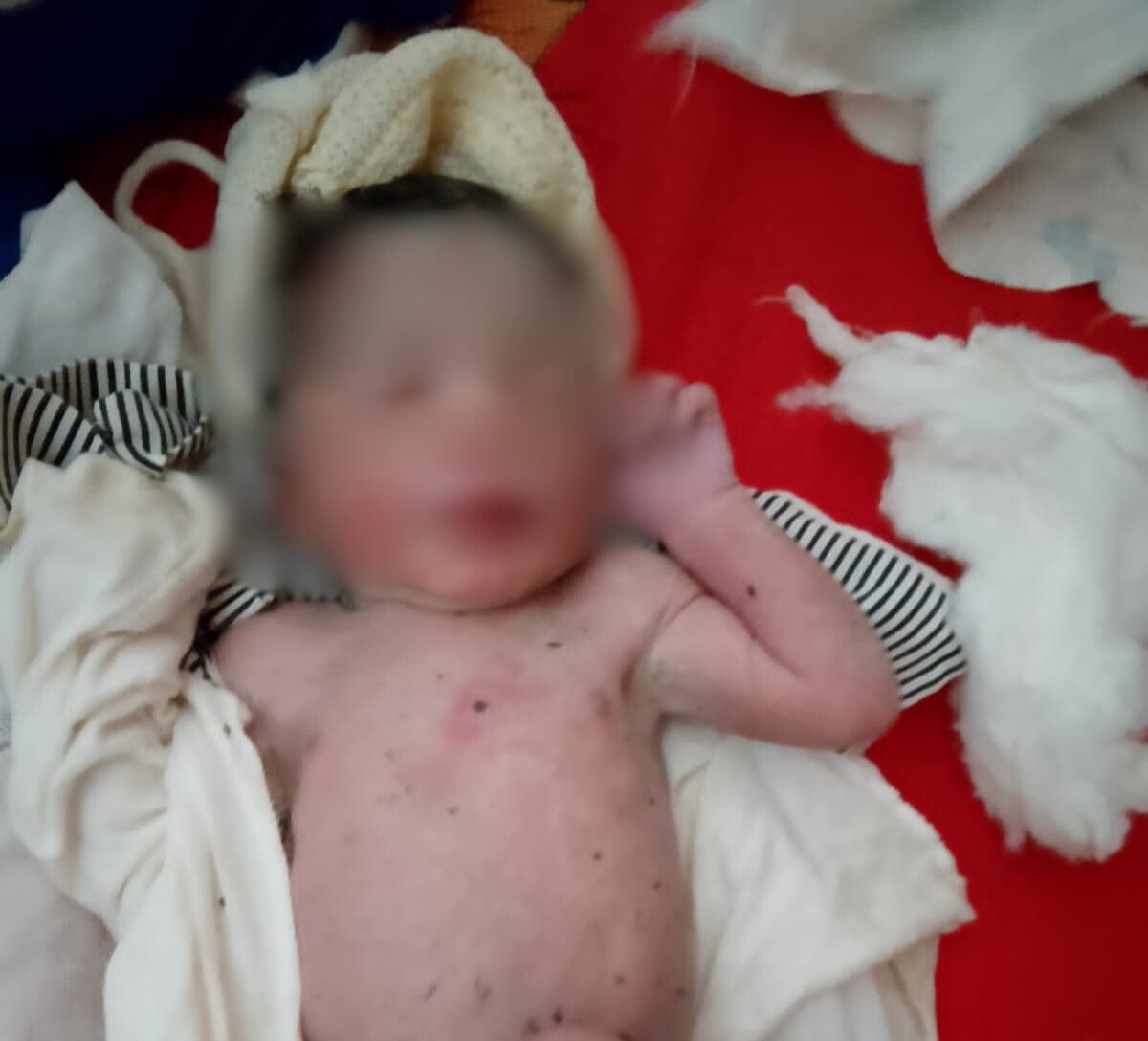 Recém-nascido é encontrado abandonado em matagal na zona rural de São Bento