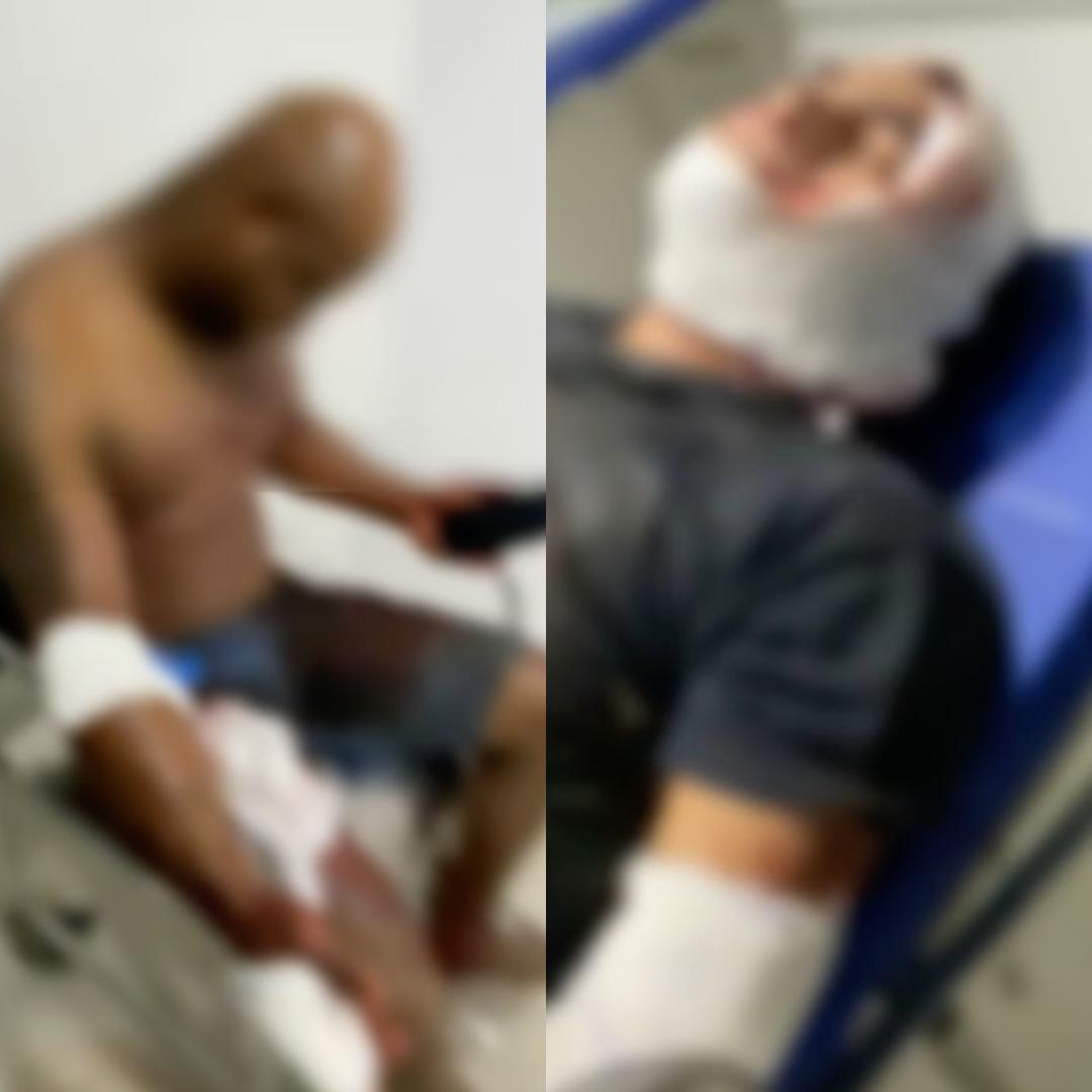 Três pessoas são atacadas por cachorros da raça pitbull, em Paço do Lumiar