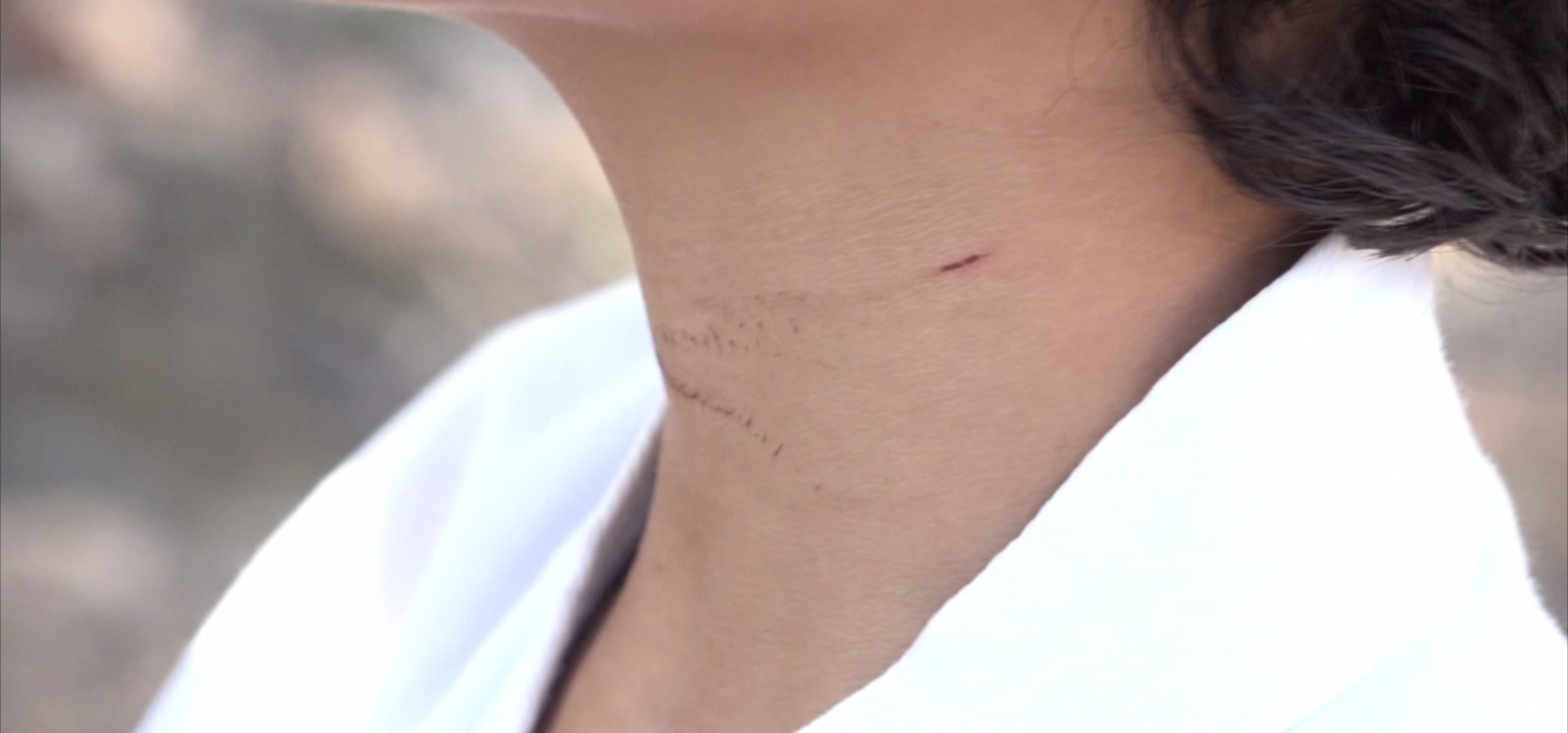 Menino de 9 anos é atingido por corda de kitesurf em praia de São Luís