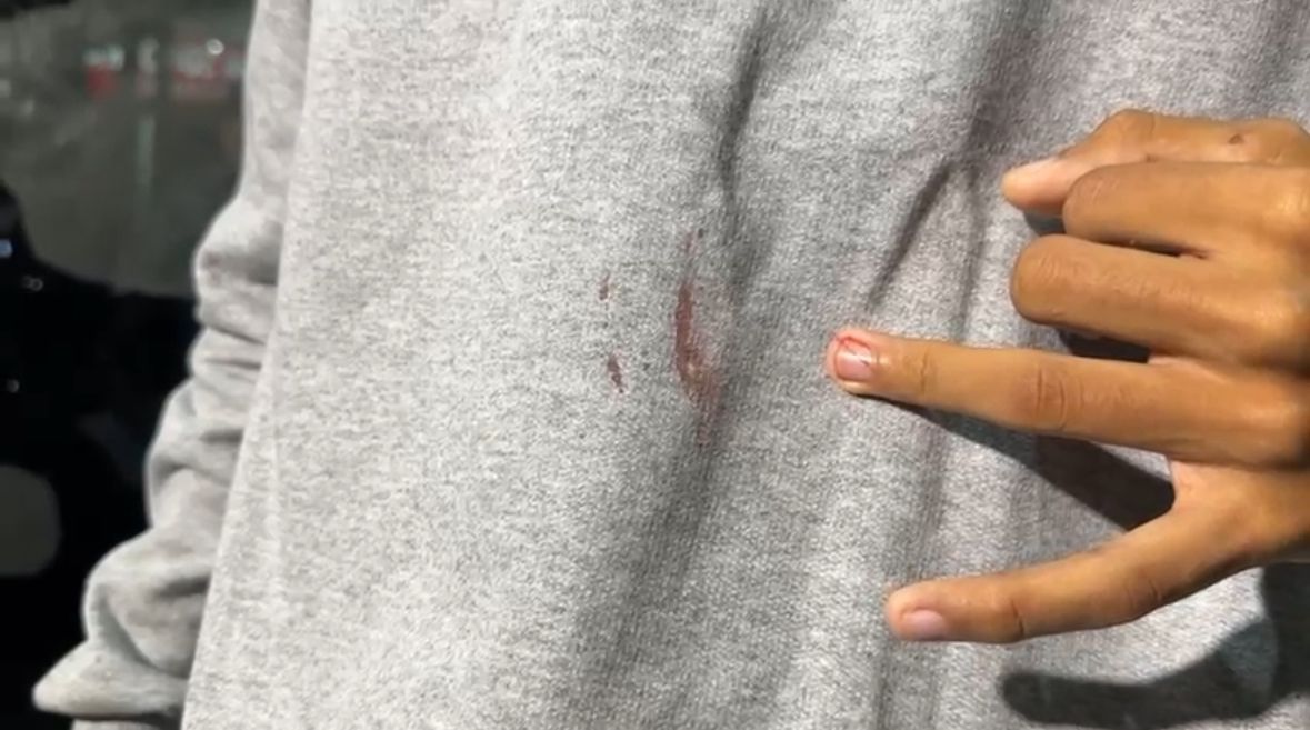 Assaltantes cortam dedo e levam até camisa de passageiro em roubo a ônibus no Anel Viário