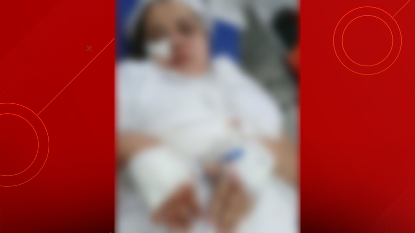 Enfermeira é agredida a facadas no rosto na Cidade Operária; ex-marido está foragido