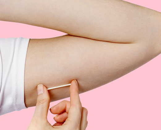 Rede básica de saúde passa a oferecer implante contraceptivo de alta eficácia em São Luís