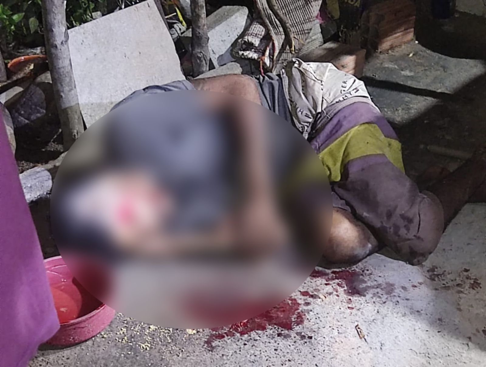 Homem é baleado no braço e na cabeça e agredido com pedaços de madeira em Belágua