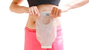 Vereador propõe isenção de IPTU a pacientes ostomizados