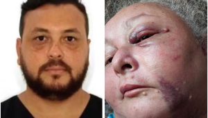 Médico preso por torturar a namorada é acusado de agressão contra a mãe