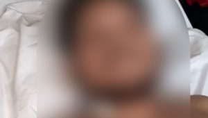 “Só senti quando vi o sangue”, diz homem esfaqueado ao tentar apartar briga na Cidade Operária