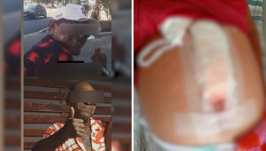 Mulher é espancada com socos, chutes e pontapés pelo companheiro na Camboa