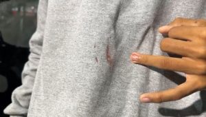 Assaltantes cortam dedo e levam até camisa de passageiro em roubo a ônibus no Anel Viário