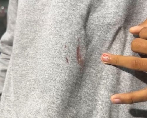 Assaltantes cortam dedo e levam até camisa de passageiro em roubo a ônibus no Anel Viário