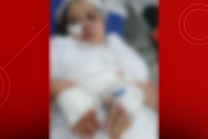 Enfermeira é agredida a facadas no rosto na Cidade Operária; ex-marido está foragido