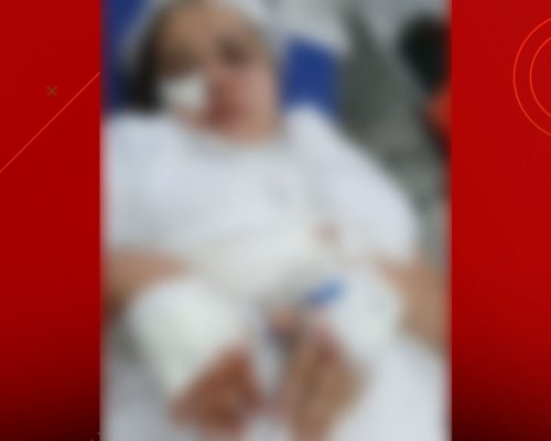 Enfermeira é agredida a facadas no rosto na Cidade Operária; ex-marido está foragido