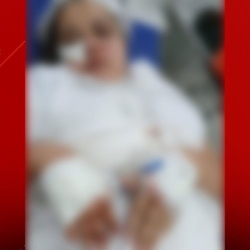 Enfermeira é agredida a facadas no rosto na Cidade Operária; ex-marido está foragido