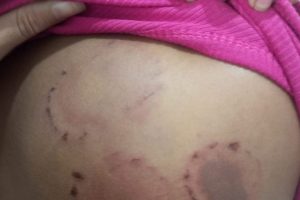 Homem é preso em Pinheiro suspeito de agredir namorada com socos e mordidas