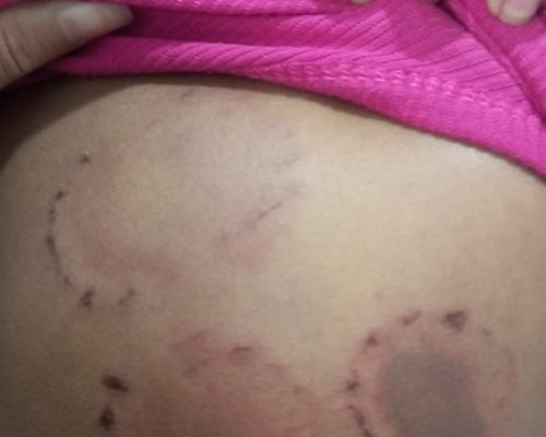 Homem é preso em Pinheiro suspeito de agredir namorada com socos e mordidas