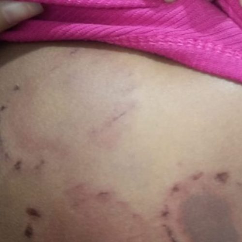 Homem é preso em Pinheiro suspeito de agredir namorada com socos e mordidas