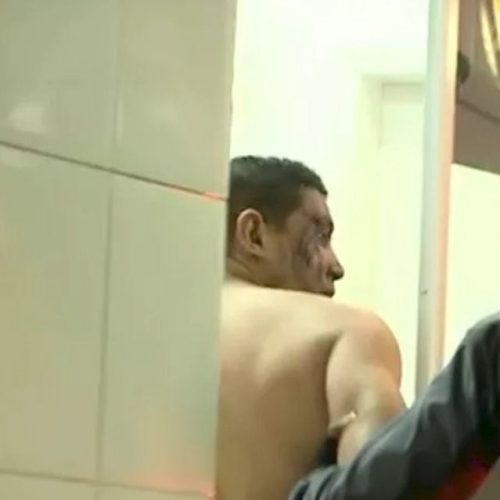 Justiça adia para abril audiência sobre caso de tentativa de femicídio em motel de São Luís