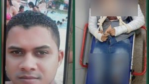 Tentativa de Feminicídio: mulher é espancada e tem os dois braços quebrados pelo ex-companheiro