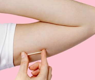 Rede básica de saúde passa a oferecer implante contraceptivo de alta eficácia em São Luís