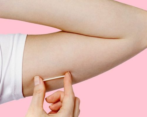 Rede básica de saúde passa a oferecer implante contraceptivo de alta eficácia em São Luís