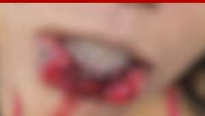 Homem arranca parte da boca da namorada e acaba preso pela polícia